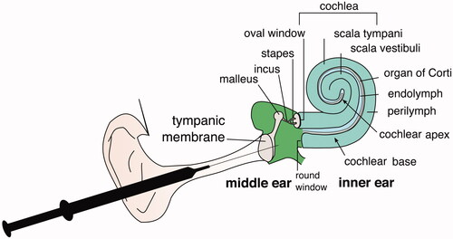 Figure 1. A schematic representation of inner ear anatomy and intratympanic drug delivery.