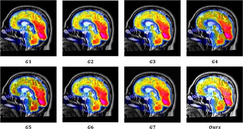 Figure 15. Results obtained from eight image fusion algorithms for MRI-PET image pair #068S in K2.