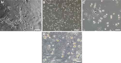 Figure 1. Phase contrast microscopy of SV40LT-HFL cells. (A) Derived from one colony after 13 days of culture in medium with puromycin, (B) from a single colony after 2 months with puromycin selection, (C) showing cells with two or three nuclei, typical of differentiating hepatocytes and (D) control adult hepatocytes. Scale bar A, B & D = 10 µm, C = 40 µm.