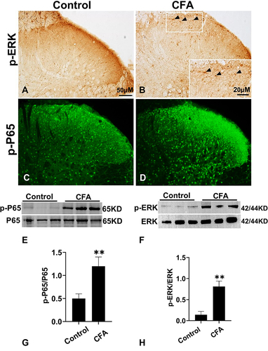 Figure 6 The expression of p-ERK1/2 and p-P65 in the spinal cord after CFA injection. (A and B) The Immunohistochemistry of p-ERK in the ipsilateral spinal cord dorsal horn of control group (A) and CFA group (B). Arrows indicate p-ERK positive expression. Scale bar = 50μM. (C and D) The immunofluorescence staining of p-P65 in spinal cord at 1d after CFA. Scale bar = 50μM. (E and F) Quantification of p-ERK (E) and p-P65 (F) expression in the ipsilateral spinal cord at 1d after CFA injection. n= 6 rat/group. *P < 0.05 versus control group. (G and H) Representative gels and quantification for p-ERK, ERK, p-P65 and P65 bands are shown. Data are expressed as mean ± SD. One-way ANOVA revealed a significant difference at **P < 0.01 vs Control group (n = 4 rat/group).