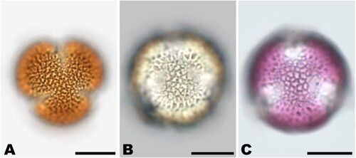 Figure 7. Brassicaceae pollen grain acetolysed (A), hydrated unstained (B) and hydrated stained with fuchsine (C). Scale bars ‒ 10 µm. Source: Karen Koelzer.