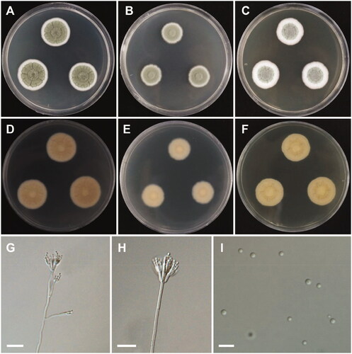 Figure 11. Morphology of Penicillium lenticrescens. A, D: Colonies on Czapek yeast autolysate agar (CYA). B, E: Colonies on malt extract agar (MEA). C, F: Colonies on yeast extract sucrose agar (YES). (A–C: obverse view, D–F: reverse view). (G, H) Conidiophores; (I) Conidia (scale bars: G, H = 20, I = 10 μm).