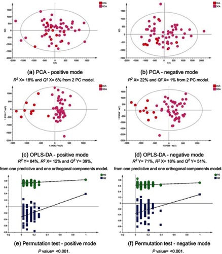 Figure 12 CCA patients vs ovarian cancer. PCA scores plots for (A) positive and (B) negative ion mode data of CCA patients and OCA patients. OPLS-DA scores plots showing group separation for both (C) positive and (D) negative ion mode data and the corresponding permutation tests for (E) positive and (F) negative ion mode data. Abbreviations: PCA, principal component analysis; CCA, cholangiocarcinoma; OCA, ovarian cancer; OPLS-DA, orthogonal projections to latent structures discriminant analysis.