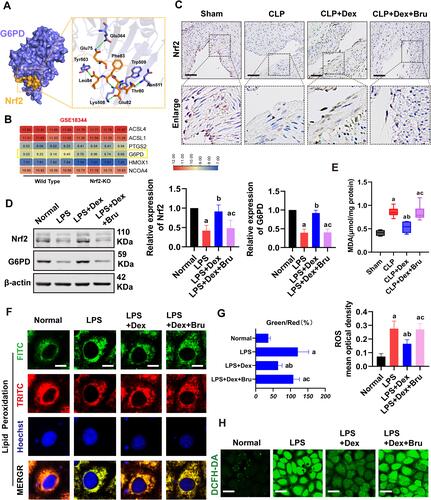 Figure 5 Dexmedetomidine inhibited ferroptosis through Nrf2 in sepsis. (A) Molecular docking of Nrf2 to G6PD. (B) Genomic analysis of G6PD between WT and Nrf2 KO mice based on GEO database (GSE18344). (C) The expression and distribution of Nrf2 in superior mesenteric veins (Bar, 50μm), n=6. (D) Western blot analysis of Nrf2 and G6PD expression in the VECs, n=3. Bru = brusatol, the Nrf2 inhibitor. (E) Effects of Nrf2 on the level of MDA, n=8. (F and G) Confocal images to observe lipid peroxidation of VECs after being treated with Bru (Bar, 10μm), n=3. (H) Effects of Dex and Bru on ROS (Bar, 20μm) of VECs, n=3. a: P<0.05 compared with the sham or normal group, b: P<0.05 compared with CLP or LPS group, c: P<0.05 compared with the CLP+Dex or LPS+Dex group.