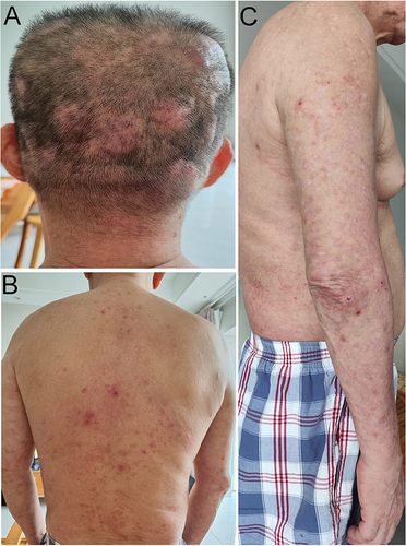 Figure 4 Clinical appearance after 6 months of treatment.