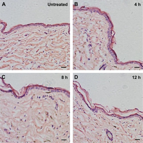 Figure 10 The histological examinations of the skin when treated by +2,000 V electret for different periods of time (untreated, 4, 8 and 12 h).Notes: The skin was stained by H&E staining. Bars represent 50 μm.Abbreviations: H&E, hematoxylin and eosin; h, hours.