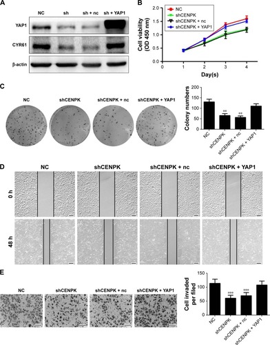 Figure 7 YAP1 modulates the effects of CENPK on HCC cell proliferation, migration, and invasion.Notes: (A) YAP1 and CYR61 expression in SMMC-7721 cells was detected by Western blotting. (B–E) Restoration of YAP1 partially rescued the inhibitory effect on proliferation, colony formation, migration, and invasion in CENPK knockdown SMMC-7721 cells as determined by the (B) CCK-8 assay, (C) colony formation assay, (D) wound healing assay, and (E) transwell assay. Scale bar =100 µm. sh represents shCENPK group; sh + nc represents shCENPK + pcDNA3.1-YAP1-NC plasmid group; sh + YAP1 represents shCENPK + pcDNA3.1-YAP1 plasmid group. The Yap1 signaling pathway modulates the effects of CENPK on HCCEMT progress. **P<0.01, ***P<0.001.Abbreviations: HCC, hepatocellular carcinoma; CCK-8, Cell Counting Kit-8; NC, negative control.