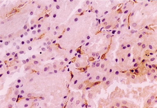 Figure 1. Immunohistochemical staining for endothelial factor VIII of peritubular capillary in MesP-NS demonstrates a rather normal staining.