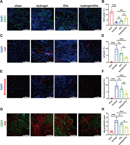 Figure 6 Intranasal delivery of EVs in the hydrogel protected endothelial function. (A and B) Representative images of ventricles staining CD31 (green) and DAPI (blue), along with quantitative results (n=5). (C and D) Representative images of ventricles staining vwf (red) and DAPI (blue), along with quantitative results (n=5). (E and F) Representative images of ventricles staining thrombocyte (red) and DAPI (blue), along with quantitative results (n=5). (G and H) Representative images of ventricles staining CD31 (green) and albumin (green), along with quantitative results (n=5). (*P < 0.05, **P < 0.01, ***P < 0.001).