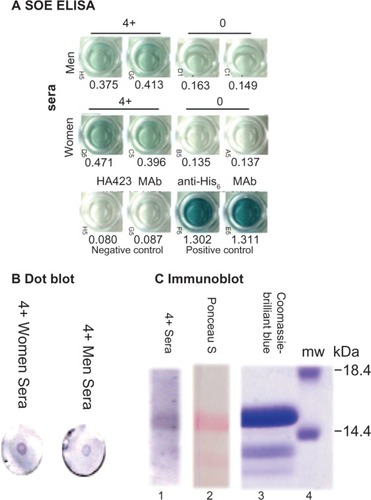 Figure 6 Immunodetection of the rSOE by ELISA (A), dot blot (B), and immunoblotting after SDS-PAGE (C).
