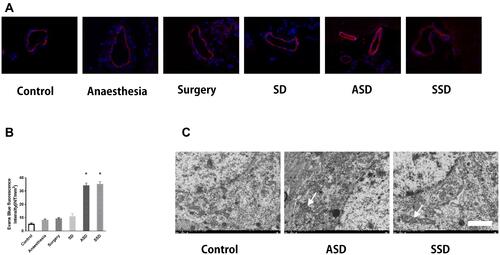 Figure 2 Changes in the blood–brain barrier (BBB) and the ultrastructure of hippocampal tissues after different interventions. (A) Changes in BBB permeability were measured based on visualization of Evans blue (EB) extravasation as indicated by red fluorescence under microscopy. (400×). (B) Quantification of EB fluorescence intensity (INT/mm2) (n=6), *F=78.124, P = 0.018 versus the Control group. (C) Transmission electron microscopy: arrows indicate mitochondrial swelling, vacuolation and endoplasmic reticulum dilatation in the hippocampal tissues of rats in the ASD and SSD groups. Scale bar = 2 μm.