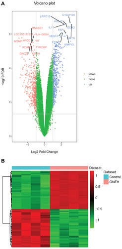 Figure 2 The volcano plot and heat map of the top 100 differentially expressed mRNAs in osteonecrosis of the femoral head. (A) The volcano plot of the top 100 differentially expressed mRNAs. The X- and Y-axes represent Log2 Fold Change and –log10 FDR, respectively. Blue and red represent up-regulated and down-regulated mRNAs, respectively. (B) The heat map of the top 100 differentially expressed mRNAs.