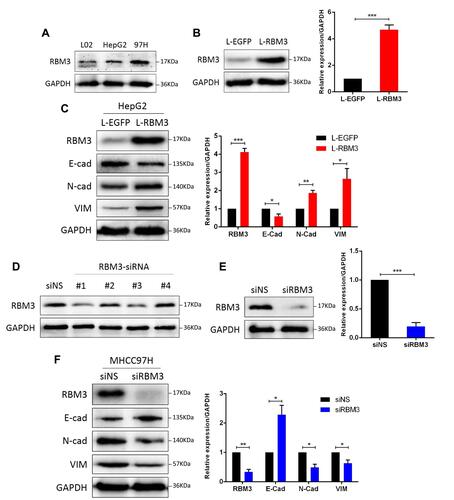 Figure 2 RBM3 promotes the EMT process in HCC cells. (A) Western blotting analysis of RBM3 expression in normal human liver cell HL-7702, hepatocellular carcinoma cells HepG2 and MHCC97H. (B) The expression of RBM3 in HepG2-EGFP cells and HepG2-RBM3 cells was detected by Western blotting. Stable cell lines were constructed by infecting HepG2 cells with lentivirus and screening with 2 μg/mL puromycin for 1–2 weeks. (C) Western blotting analysis of the expression of EMT-related factors in HepG2-EGFP cells and HepG2-RBM3 cells. (D) Knockdown efficiency of 4 designed siRNAs for RBM3 expression in MHCC97H cells. (E) Western blotting analysis of RBM3 expression in MHCC97H cells transfected with a mixture of RBM3-specific siRNA#1 and #3. (F) Western blotting analysis of EMT markers was performed in MHCC97H cells transfected with non-specific siRNAs or RBM3-siRNAs. siRNA was added to the cells for 6 hours and total protein was collected after 48 hours. Relative levels of RBM3, E-cadherin, N-cadherin and Vimentin were quantitatively analyzed using Image J. Results are the mean ± SEM (error bar) from three independent experiments. *P < 0.05, **P < 0.01, ***P < 0.001.