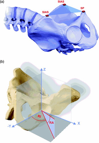 Figure 1. Definition of the APP concept (a) and radiological inclination (RI) and anteversion (RA) (b). The pelvic reference plane (xy plane) is defined by the iliac anterior superior spines (SIAS) and the pubic spine (SP). [Color version available online].