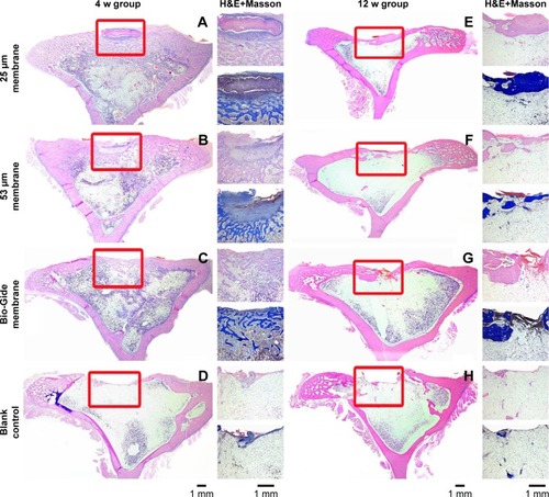 Figure 4 Histological analysis results at the end of 4 and 12 weeks. H&E-stained images of regenerated bone at 4 weeks (A–D) and 12 weeks (E–H) after membrane implantation. The entire images (left) and magnified images (right) were separated on both sides. The boxed areas in the images on the left show the lateral margin and central region of the rabbit tibia defect beneath the membranes. The images on the right show H&E staining and Masson’s trichrome staining. In the tested membrane group, the transition of newly formed bone from cancellous bone to mature lamellar bone structure was observed.Abbreviation: w, week.