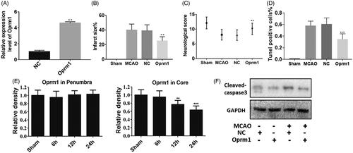 Figure 3. Functional analysis of lncRNA Oprm1 in vivo. (A) Overexpression of lncRNA Oprm1 was verified through qPCR. (B) Infarct size was measured via TTC staining, and infarct size was significantly reduced in Oprm1 overexpressed group. (C) There is no difference in penumbra. (D) Overexpression of Oprm1 significantly reduced the cell apoptosis. (E) The expression of Oprm1 was manifestly reduced in the development of reperfusion. (F) Cleaved-caspase3 was distinctly decreased in Oprm1 overexpressed group in vivo. **p < .01.