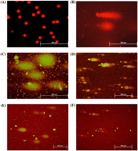 Figure 2. DNA damage after the pesticide mixture treatments in the human lymphocytes visualized with ﬂDNA damage microscopy. (A) solvent control (undamaged); (B) H2O2 treatment; (C) PM1 treatment; (D) PM2 treatment; (E) L1PM2 treatment; (F) L2PM2 treatment.