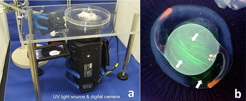 Figure 1 Visualization of residual ophthalmic viscosurgical device. (a) The UV light source and digital camera. The UV light source was illuminated from the side of the posterior pole. The porcine eye was photographed from the posterior pole side using a digital camera. (b) A representative image that shows fluorescein in the residual ophthalmic viscosurgical device visualized under UV light (white arrows).
