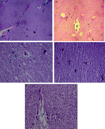 Figure 12. Effect of A. wilhelmsii essential oil on histopathological changes 24 h after APAP administration. Light microscopy showed histologic sections of liver of rats from different groups of animals. (A) Negative control group (NC) (original magnification × 40). (B) Control group (C) (original magnification×40). (C) Essential oil treatment group (100 mg/kg) (original magnification × 100). (D) Essential oil treatment group (200 mg/kg) (original magnification × 100). (E) Positive control group (10 mg/kg BHT) (original magnification × 100).