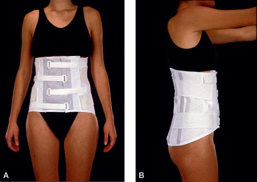 Figure 10:2 Lumbar canvas corset with molded plastic posterior support. A. Anteroposterior view. B. Lateral vew. (Reproduced with permission from J Spinal Disord).