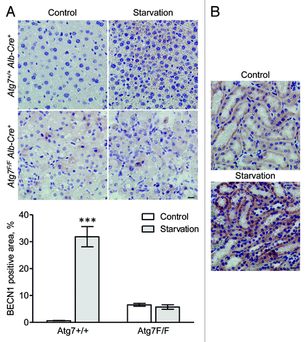 Figure 14. BECN1 is upregulated in mouse tissue after starvation. (A) Liver samples were isolated from fed Atg7+/+ Alb-Cre+ and Atg7F/F Alb-Cre+ mice (control) or from mice that underwent starvation for 48 h. After fixation in neutral buffered formalin for 24 h, tissues were paraffin-embedded and stained for BECN1 using rabbit polyclonal anti-BECN1 (Lifespan, 1:1,000) and Vectastain ABC. Heat-mediated antigen retrieval was performed in citrate buffer (pH 6.0). Scale bar 20 μm. The BECN1 positive area was quantified. ***p < 0.001 vs. control (two-way ANOVA with Bonferroni post test, n, 10). (B) BECN1 immunohistocehmical staining in kidney from Atg7+/+ Alb-Cre+ mice before and after starvation (48 h). Scale bar, 20 μm.