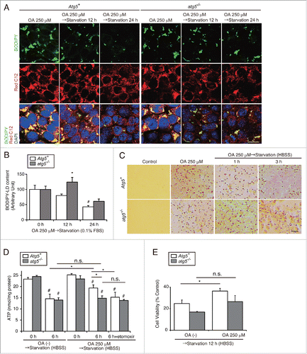 Figure 5. Lipophagy produces ATP for cell survival in the proximal tubules during starvation in vitro. Effects of starvation-induced lipophagy on cellular energy homeostasis and cell survival were studied. (A and B) Autophagy-competent and -deficient PTCs were supplied with 250 μM OA containing Red C12 for 12 h and then incubated with serum-limited medium (0.1% FBS) for the indicated periods of time. LDs were labeled with BODIPY 493/503. BODIPY 493/503-positive LD content per cell was quantified in the indicated conditions. Counterstaining was performed with DAPI (blue) (n = 5 in each group). (C to E) Autophagy-competent and -deficient PTCs were supplied with 250 μM OA for 12 h and then incubated with HBSS with or without 40 μM etomoxir for the indicated periods of time (n = 3 to 5 in each group). (C) Images of Oil Red O staining. (D and E) Cellular ATP level (D) and cell survival rate (MTS assay) (E) were measured. (B and E) Data are expressed as the fold change relative to the mean value of control PTCs. Bars: 10 μm (A) and 50 μm (C). All images are representative of multiple experiments. Data are provided as mean ± SE. Statistically significant differences (*P < 0.05 vs. autophagy-competent cells of the corresponding condition; #P < 0.05 vs. control PTCs) are indicated. Atg5+, autophagy-competent PTC; atg5−/−, autophagy-deficient PTC.