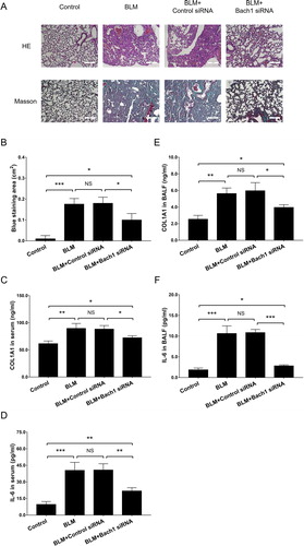 Figure 3. Bach1 siRNA adenovirus reduced fibrosis and inflammation in PF mice. H&E staining and Masson’s trichrome staining of lung tissues (A), blue staining area of Masson’s trichrome staining (B), ELISA assessed COL1A1 expression in serum (C), COL1A1 expression in BALF (D), IL-6 expression in serum (E), and IL-6 expression in BALF (F) from PF mice. Three mice were used in each group in the animal experiments. Bach1, BTB and CNC homology 1; COL1A1, collagen type I alpha 1 chain; IL-6, interleukin-6; H&E, hematoxylin-eosin; BALF, bronchoalveolar lavage fluid; ELISA, enzyme-linked immunosorbent assay.