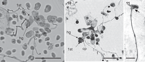 Figs 9–11. Kallymenia ercegovicii Vergés & Le Gall, sp. nov. (PC0152698): Reproductive structures. Scale bar = 40 µm. Figs 9–10. Polycarpogonial female reproductive structures (1st: first carpogonial branch cell, cp: carpogonium, hg: hypogynous cell, sc: supporting cell, t: trichogyne). Fig. 11. Apical part of a connecting filament (arrow).