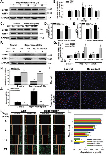 Figure 4. Involvement of HECTD1 in I/R-induced ER stress in HUVECs. (A) Representative western blot showing that I/R increased the expression of ERN1 and ATF6. (B) Densitometric analysis of ERN1 and ATF6 protein expression levels from five independent experiments; *P < 0.05 vs. the control group. (C) Representative western blot depicting the effect of HECTD1 ACT on ERN1 and ATF6 protein expression. Densitometric analysis of ERN1 (D) and ATF6 (E) protein expression levels from five independent experiments; *P < 0.05 vs. the control group; #P < 0.05 vs. the I/R group. (F) Representative western blot showing that MG132 abolished the effects of HECTD1 ACT on I/R-induced ERN and ATF6 changes. (G) Densitometric analysis of ERN1 and ATF6 protein expression levels from five independent experiments; *P < 0.05 vs. the control group, #P < 0.05 vs. the I/R group. (H) CCK-8 assay results showing that salubrinal attenuated the I/R-induced decrease in HUVEC cell viability. *P < 0.05 vs. the control group, **P < 0.01 vs. the control group; ##P < 0.01 vs. the I/R group, n = 5. (I) Representative images of Hoechst 33342 staining of HUVECs after I/R. (J) Hoechst 33342 staining demonstrating that apoptosis induced by I/R was attenuated by salubrinal in HUVECs; *P < 0.05 vs. the control group, **P < 0.01 vs. the control group; ##P < 0.01 vs. the I/R group, n = 5. (K) Representative images from a scratch assay showing that the I/R-induced increase in cell migration was attenuated by salubrinal. (L) Quantification of the scratch gap distances from six independent experiments; *P < 0.05 vs. the corresponding time point in the control group; #P < 0.05 vs. the corresponding time point in the I/R group.