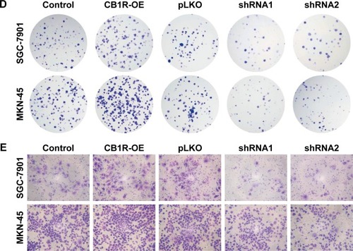 Figure 2 Enhanced expression of CB1R promotes the proliferation and invasion of GC cells.