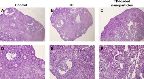 Figure 6 The changes in ovarian histomorphology in the three groups.Notes: (A–C): hematoxylin and eosin ×100; (D–F): hematoxylin and eosin ×200. Different stages of developing follicles and distinct corpus luteum were clearly observed in the control and TP groups. Follicle development was suppressed in the TP-loaded nanoparticle group, and few corpus lutea were observed. Ovarian tissue was seriously damaged, with overt ovarian fibrosis and vacuolar changes.Abbreviation: TP, triptolide.