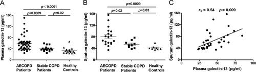 Figure 1. Levels of galectin-13 in plasma and sputum. (A) The plasma galectin-13 levels in AECOPD patients (n = 44), stable COPD (n = 16), and healthy controls (n = 15). (B) The induced sputum galectin-13 levels in AECOPD patients (n = 18), stable COPD patients (n = 9), and healthy controls (n = 8). (C) The correlation between plasma and induced sputum galectin-13 expression.