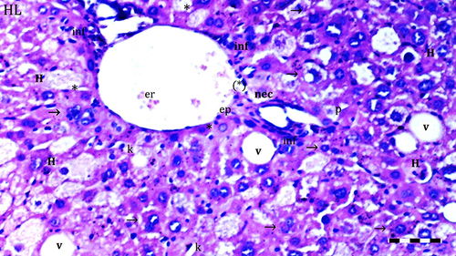 Figure 3 Representative light microscopy of hepatic tissue from DIR group. Scale bar 50 µm, H&Ex100.