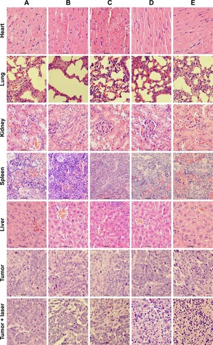 Figure 7 Histologic assessments of major organs and tumor tissues with H&E staining in mice.Notes: (A) PBS, (B) gemcitabine, (C) MWNTs, (D) MWNTs-Ge, (E) MWNTs-Ge-Le. Bar = 10 μm.Abbreviations: H&E, hematoxylin and eosin; MWNTs, multiwalled carbon nanotubes; MWNTs-Ge, multiwalled carbon nanotubes/gemcitabine; MWNTs-Ge-Le, multiwalled carbon nanotubes/gemcitabine/lentinan; PBS, phosphate-buffered solution.