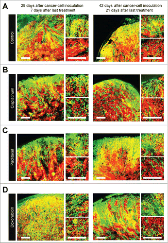 Figure 4. Quiescent/dormant cancer cells induce nascent tumor vessels after chemotherapy. Experimental setup: FUCCI-expressing MKN45 cells (1×107 cells/mouse) were injected subcutaneously into the left flanks of nestin-GFP transgenic nude mice. When the tumors reached approximately 6 mm in diameter (tumor volume, 80–100 mm3), mice were intraperitoneally injected with CDDP (4 mg/kg), PAX (5 mg/kg) or DOX (6 mg/kg) for 3 cycles every 3 d. Representative images of cross-sections of FUCCI-expressing MKN45 subcutaneous tumor of control (A), treated with CDDP (B), PTX (C), or DOX (D) 7 d and 21 d after last treatment. Low-magnification image (left). High-magnification image (right). Superficial area image (upper right). Deep area image (lower right). The cells in G0/G1, S, or G2/M phases appear red, yellow, or green, respectively. (D) Histograms show the number of tumor vessels in the surface area or the center area in tumor of control, CDDP, PAX, or DOX 7 d after last treatment. (E) Bar graphs show the number of tumor vessels at the surface and deep area of control, CDDP-, PAX-, or DOX-treated tumors 21 d after last treatment. (F) Shows length of tumor vessels of control, CDDP-, PAX-, or DOX-treated tumors 21 d after last treatment. Data are shown as means ± SD (n = 5). Scale bars, 500 μm.