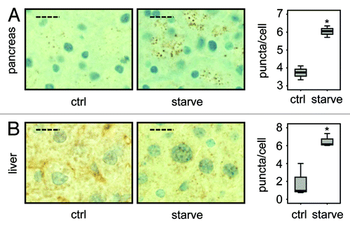 Figure 4. LC3 staining reveals quantitative differences in endogenous LC3 puncta formation. Representative immunohistochemical staining for LC3 in murine pancreas (A) and liver (B) from control mice (i.e., with access to food ad libitum) and mice starved for 14 h (but with free access to water). The panels are representative crops from images taken at 40x magnification and the dashed scale bars represent 20 µm. Box plots are used to display the quantification of LC3-puncta/cell for each condition. “*” indicates statistical significance (p < 0.05, Mann-Whitney). LC3-positive puncta of at least 150 cells (exocrine pancreas or hepatocytes respectively) from each of three mice in every group were counted. Antigen retrieval for LC3 was undertaken in Tris-EDTA, pH 9.
