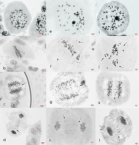 Figure 9. Meiosis I cells of Saccharum officinarum L. (OIO, 1000×): (a–d) var. VMC 84-194: (a) binucleated cell with 53II; (b) non-congression at metaphase I; (c) anaphase I with laggards; (d) telophase I with laggards. (e–h) var. PHIL 89-43: (e) diakinesis with 45II; (f) metaphase I with laggards; (g) anaphase I with laggards; (h) telophase I with laggards. (i–l) var. PSR 00-34: (i) diakinesis with 50II; (j) metaphase I with tripolar spindle; (k) anaphase I with laggards; (l) telophase I with laggards.