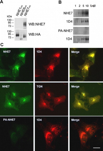 Supplementary Figure 2.  Characterization of anti-NHE7 antibody. A. HA-tagged NHE1, NHE6 or NHE7 was transiently transfected to CHO cells, and cell lysates from each transfectant was analyzed by Western blot. Anti-NHE7 antibody detected only NHE7HA, but not NHE1HA or NHE6HA, showing the specificity of this antibody (top panel). The same blot was stripped and reprobed with anti-HA antibody (bottom panel). (B) Increasing amounts (1–10 µg) of MDA-MB-231/NHE71D4 cell lysates were resolved in SDS-PAGE, transferred to a PVDF membrane and probed with anti-NHE7 antibody (NHE7, left panel) or pre-absorbed anti-NHE7 antibody (PA-NHE7, right panel) for Western blot. The same blot was stripped and re-probed with 1D4 antibody (bottom panel). (C) MDA-MB-231/NHE71D4 cells grown on glass coverslips were fixed and double stained with either 2 µg/ml anti-NHE7 antibody (NHE7, top panels) or pre-absorbed anti-NHE7 antibody (PA-NHE7, bottom panels) and 1D4 antibody. Anti-TGN46 antibody (20 µg/ml) was used as a TGN marker. NHE7 and 1D4 were visualized with Alexa 488- and Alexa 568-conjugated secondary antibodies respectively. Bars, 10 µm. A set of representative results of three independent experiments was shown.