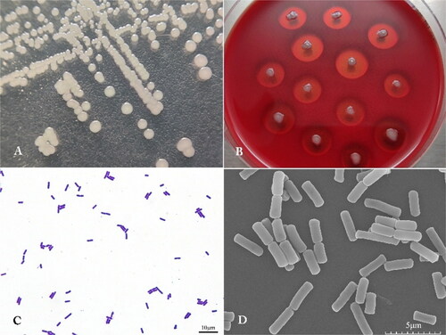 Figure 2. Morphological features of strain Y271. (A) Bacterial colony. (B) βhemolytic ring. (C) Gram staining (bar scale: 10 μm). (D) Scanning electron microscope (bar scale: 5 μm).