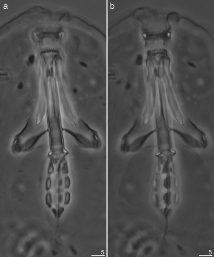 Figure 5. Mesobiotus mandalori sp. nov. —PCM images of the entire buccal apparatus: (a) — dorsal view of entire buccal apparatus (holotype); (b) — ventral view of entire buccal apparatus (holotype). Scale bars in μm.