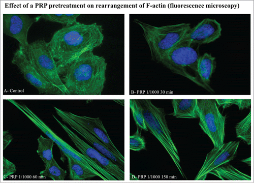Figure 4. Effect of a PRP treatment on rearrangement of acin microfilaments. Images of phalloidin stained SaOS cells treated with culture media (A), with PRP 1/1000 for 30 minutes (B), with PRP 1/1000 for 60 minutes (C), with PRP 1/1000 for 150 minutes (D). Images in fluorescence microscopy at 63× magnification.