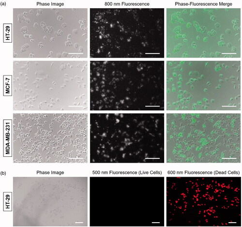 Figure 3. (a) Live binding of COL-ZW to HT-29, MCF-7, and MDA-MB-231 cells. Phase contrast and NIR fluorescence images of each cell line were obtained using 2 μM COL-ZW. The sample concentration is calculated using the absorbance value of the ZW800-1 NIR fluorophore. Green pseudo-colour is used for phase-fluorescence merged images. (b) Fluorescence images of HT-29 cells after photothermal treatment under the 808 nm laser irradiation (1.1 W/cm2) for 5 min. HT-29 cells were then costained with calcein-AM (green for live cells) and propidium iodide (red for dead cells). Images are representative of three independent experiments. All fluorescence images have been subjected to identical exposure time and normalisation. Scale bars = 100 μm.