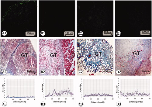 Figure 4. Histological section from wound area on day 3 after wound induction; immuno-fluorescent staining for fibroblast are presented in first row (A1–D1). See that REO-NLCs and the REO significantly stimulated the fibroblasts infiltration. Figure A2–D2 are representing the granulation tissue generation in different groups. See well-formed granulation tissue in REO and REO-NLCs-treated groups versus mupirocin and control animals. The software analyses for fibroblast distribution are represented in Figure A3-D3. See intensive fibroblast distribution in REO-NLCs-treated group (A: Control, B: Mupirocin-treated, C: REO-treated and D: REO-NLCs-treated).