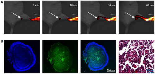 Figure 2 Dynamic fluorescence images of ICG-HSA NPs for mice SLN and slice examination of SLN. (A) The dynamic imaging of fluorescence from 1 minute to 60 minutes. The fluorescence signal of ICG-HSA NPs in popliteal LNs can be seen 1 min after injection, and the fluorescence signal increases continuously over time. Arrows indicate the popliteal LNs; (B) From left to right: DAPI, FITC-ICG-HSA NPs fluorescence, overlay images, and H&E staining of popliteal LN tissue sections (40x magnification).