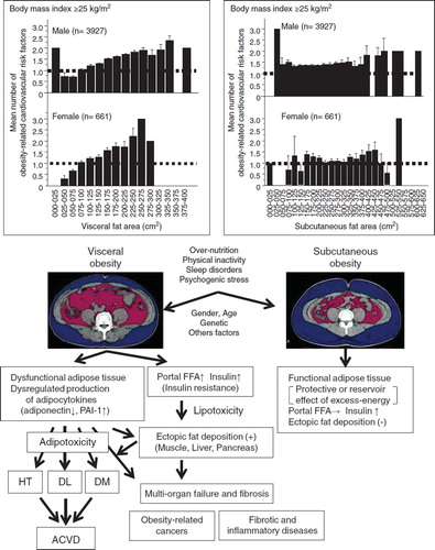 Figure 1. Visceral obesity and subcutaneous obesity. Top: Correlation of visceral fat area and subcutaneous fat area with obesity-related cardiovascular risk factors in obese subjects (body mass index ≥25 kg/m2). Bottom: Schematic diagrams of the complications associated with visceral obesity (left) and subcutaneous obesity (right). Reproduced with permission from Annals of Medicine (Citation40). (HT = hypertension; FFA = free fatty acids; DL = dyslipidemia; DM = diabetes mellitus; ACVD = atherosclerotic cardiovascular disease).