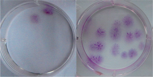Figure 3. Representative images of stained colonies of CFU‐Fs cultured from the same volume of BMAs (left) and bm‐BC samples (right).