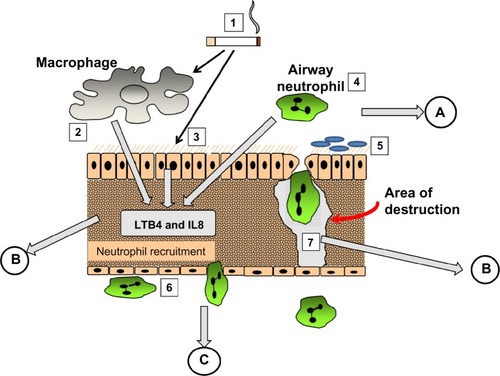 Figure 3 The pathological process involved in emphysema. (1) cigarette smoke activates macrophages (2), epithelial cells (3) and airway neutrophils (4) to release pro inflammatory cytokines and neutrophil chemoattractants. At the same time oxidant stress in smoke damages local airway proteins (3). Harvesting airway secretions (A) detects markers of these effects including the influence of airway colonisation (5) and local mucus over production. The chemokines activate endothelial cells and circulating neutrophils (6) leading to adhesion and migration. Blood biomarkers (C) reflect these events. Migrating neutrophils ± local activated macrophages destroy connective tissue releasing specific fragments into the lymph and together with locally produced chemokines circulate into the circulation where they can be detected (B).