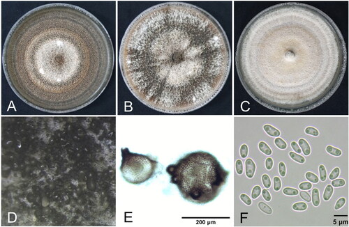 Figure 2. Cultural and morphological features of Didymella acutilobae sp. nov. (A) Two-week-old colonies on malt extract agar; (B) oatmeal agar; (C) potato dextrose agar. (D, E) Pycnidia produced in oatmeal agar. (F) Conidia.