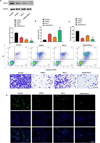 Figure 6. Effect of oHSV2 in combination with PD-1/PD-L1 immune-checkpoint inhibitors on DLBCL cell behavior. (A) Western blotting assessment of the PD-L1 protein level in SU-DHL-4 cells under oHSV2 or/and PD-L1 antibodies treatment, one-way ANOVA and t-test. (B) Flow cytometry assessment of the apoptosis ability of SU-DHL-4 cells under oHSV2 or/and PD-L1 antibodies treatment, one-way ANOVA and t-test. (C) Transwell assessment of the invasion ability of SU-DHL-4 cells under oHSV2 or/and PD-L1 antibodies treatment, scale bar: 100 μm, one-way ANOVA and t-test. (D) EdU staining assessment of the proliferation ability of SU-DHL-4 cells under oHSV2 or/and PD-L1 antibodies treatment, scale bar: 100 μm. *p<.05, **p<.01, ***p<.001 vs control group. #p<.05, ##p<.01 vs oHSV2 or PD-L1 group. n = 3.