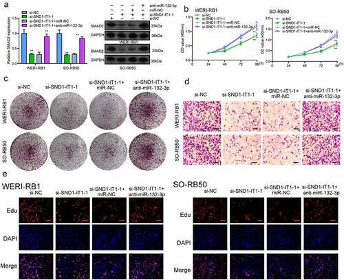 Figure 7. Knockdown of miR-132-3p attenuates the regulatory effects of SND1-IT1 knockdown on the progression of RB cells. (a) The expression levels of SMAD2 in WERI-RB1 and SO-RB50 cells after knockdown of SND1-IT1 and/or inhibition of miR-132-3p. The CCK-8 assays (b), colony formation assays (c), Cell invasion(d), Edu assays (e) following knockdown of SND1-IT1 and/or inhibition of miR-132-3p. *p < 0.05, **p < 0.01